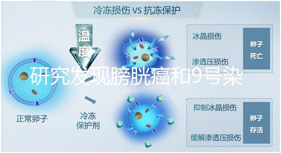 研究發(fā)現(xiàn)膀胱癌和9號(hào)染色體缺失有關(guān)系!