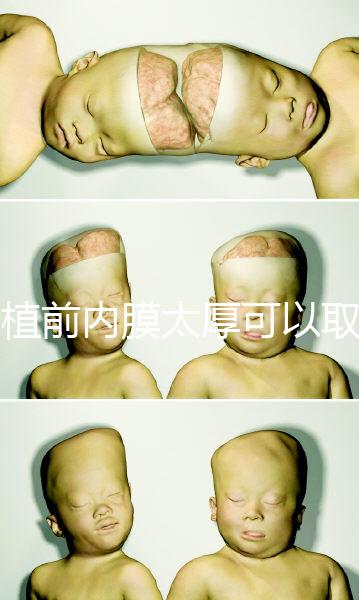 移植前內膜太厚可以取卵早知道，疼痛因人而異