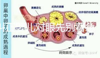 糾正嬰兒對眼先別著急，眼科醫生教你3招鑒別法