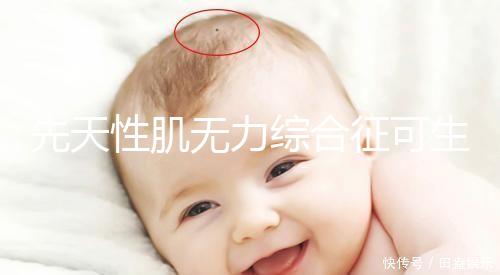 先天性肌無力綜合征可生育嗎？能做試管避免遺傳？