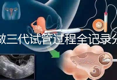 做三代試管過(guò)程全記錄分享（北醫(yī)三院）