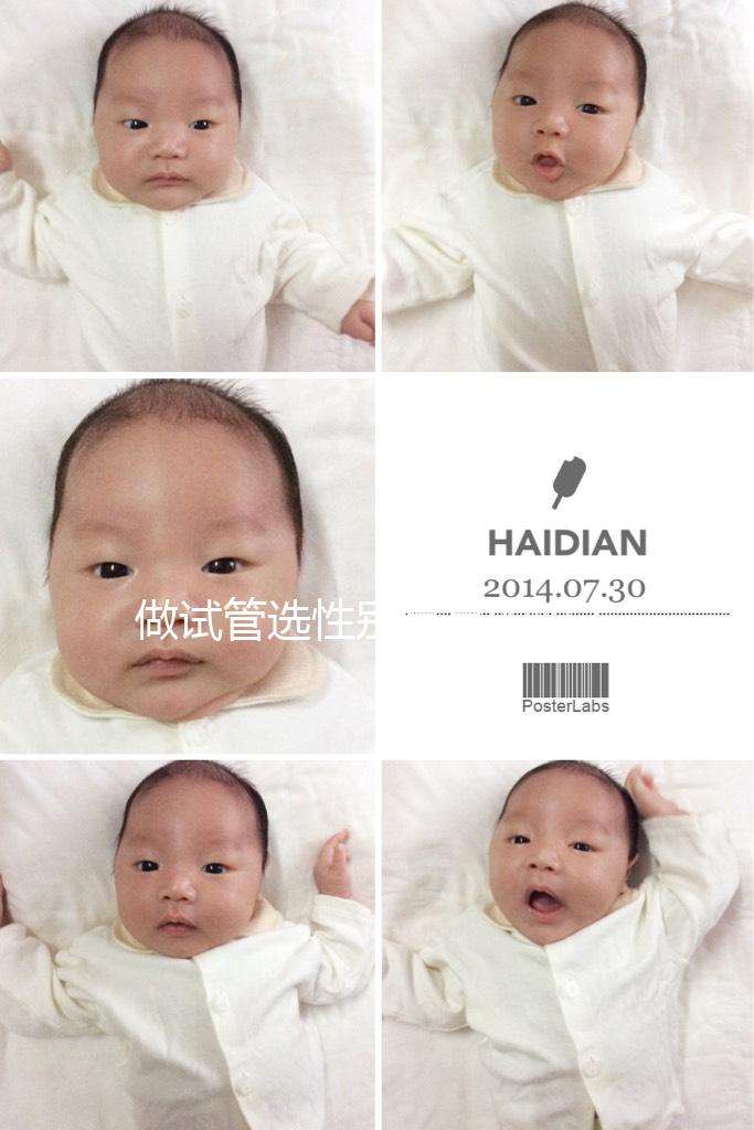 做試管選性別是真的嗎(做試管嬰兒選性別)