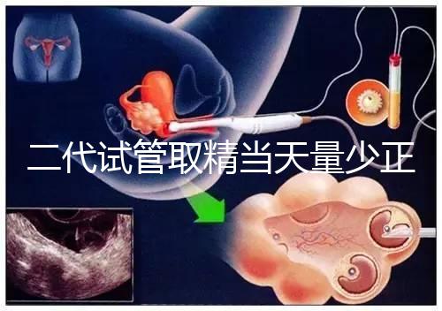 二代試管取精當天量少正不正常60s弄清，不造怎么辦速覽