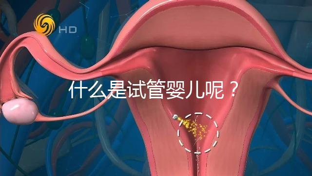 什么是試管嬰兒呢？