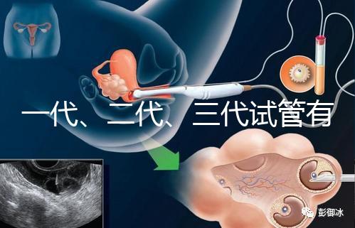 一代、二代、三代試管有什么區別？