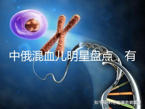 中俄混血兒明星盤點(diǎn),有的長(zhǎng)相特征真不明顯