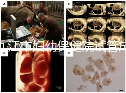 九江市婦幼保健院試管成功率高、費用低？生殖醫生揭開真相