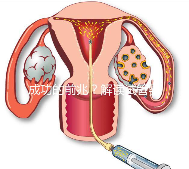 成功的前兆？解讀試管嬰兒移植后為什么容易出汗