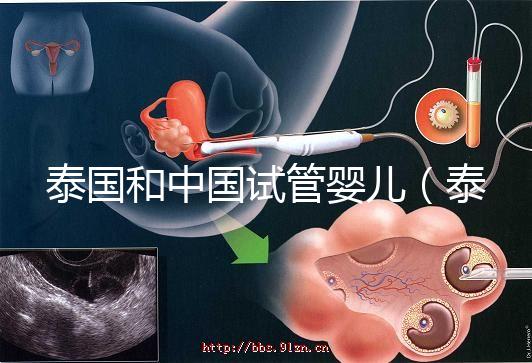 泰國和中國試管嬰兒(泰國和中國試管嬰兒技術差距)
