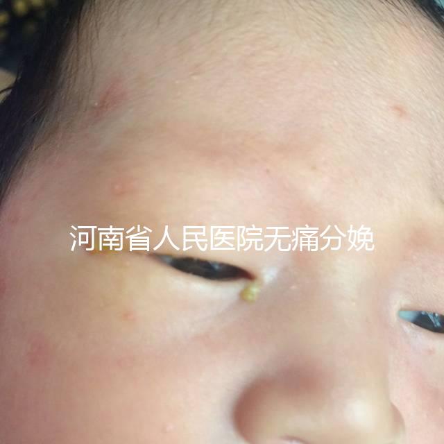 河南省人民醫院無痛分娩多少錢戳，收費標準60s看懂不踩坑