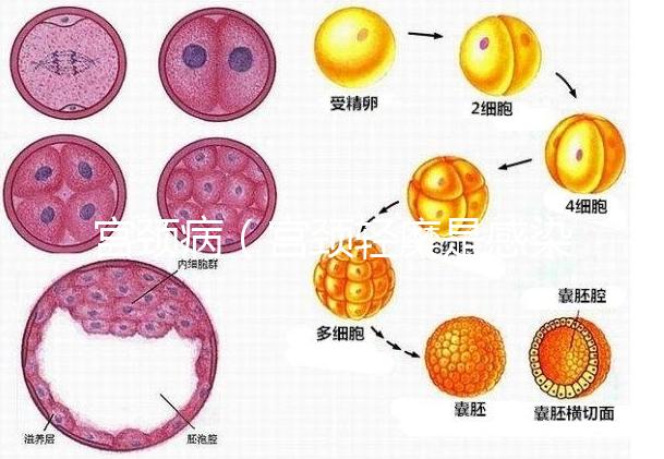 宮頸?。▽m頸輕糜是感染了hpv嗎）