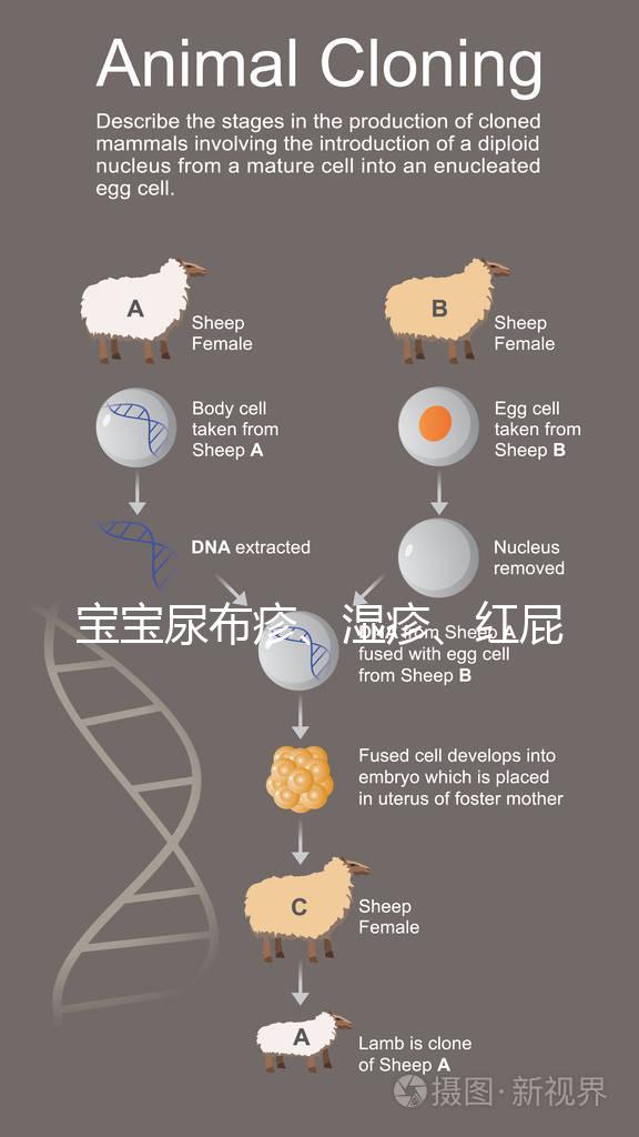 寶寶尿布疹、濕疹、紅屁股傻傻分不清？4點區別輕松診斷