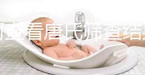 如何查看唐氏篩查結(jié)果，珠海醫(yī)院價(jià)格二百四起