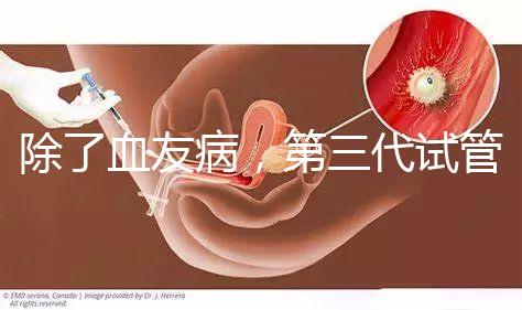 除了血友病，第三代試管嬰兒技術(shù)(PGD)還能篩查什么疾病？