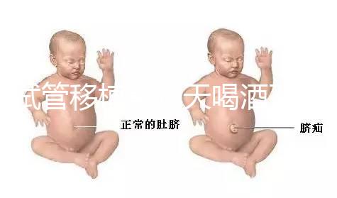 試管移植前幾天喝酒了有影響嗎？想要懷孕得管住嘴！