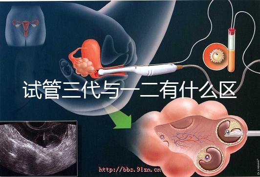 試管三代與一二有什么區別的??
