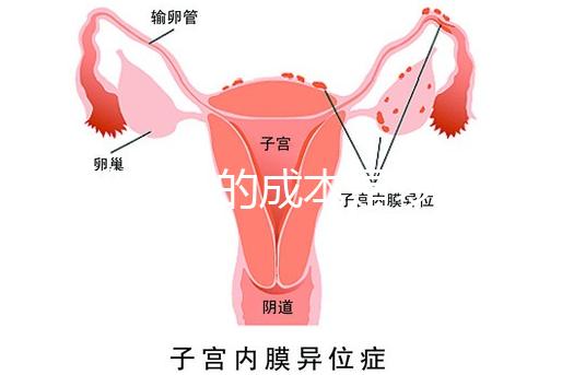 試管嬰兒的成本是多少？需要多少錢(qián)？