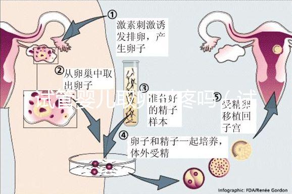 試管嬰兒取卵時(shí)疼嗎(試管嬰兒取卵時(shí)疼嗎,取卵多長時(shí)間才是移植)