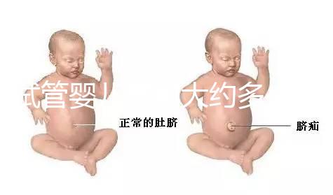 試管嬰兒費(fèi)用大約多少2020年(試管嬰兒費(fèi)用大約多少2020年上海)