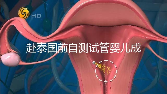 赴泰國前自測試管嬰兒成功率，這些方法值得收藏