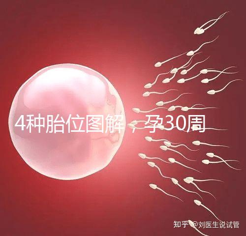 4種胎位圖解，孕30周這個姿勢最適合順產