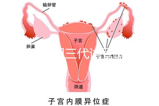 2025昆明三代試管助孕機構(gòu)收費明細(xì),價格8萬至15萬不等